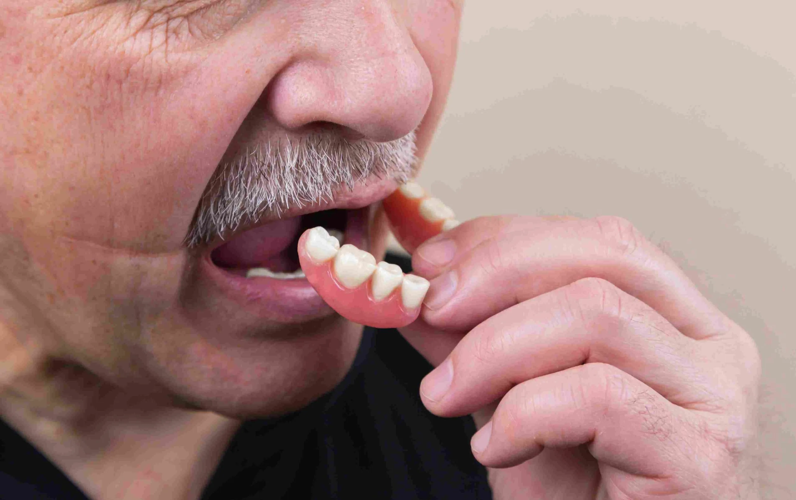 Everything You Need To Know After Getting Dentures Klinik Gigi Near Me