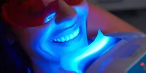 How Do Teeth Whitening Prices Compare in Malaysia