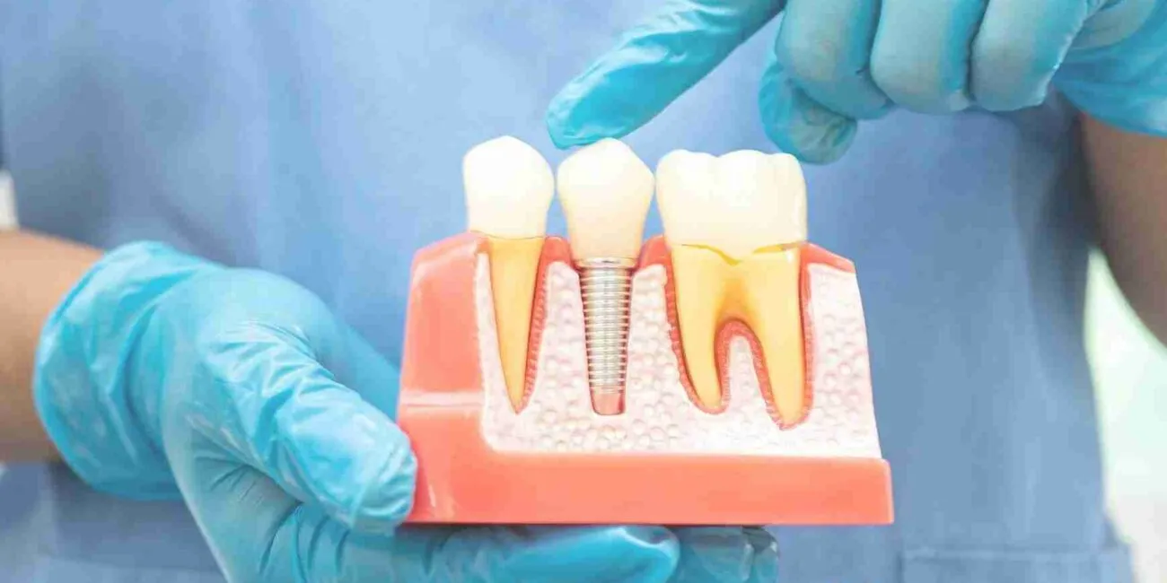 root canal treatment cost