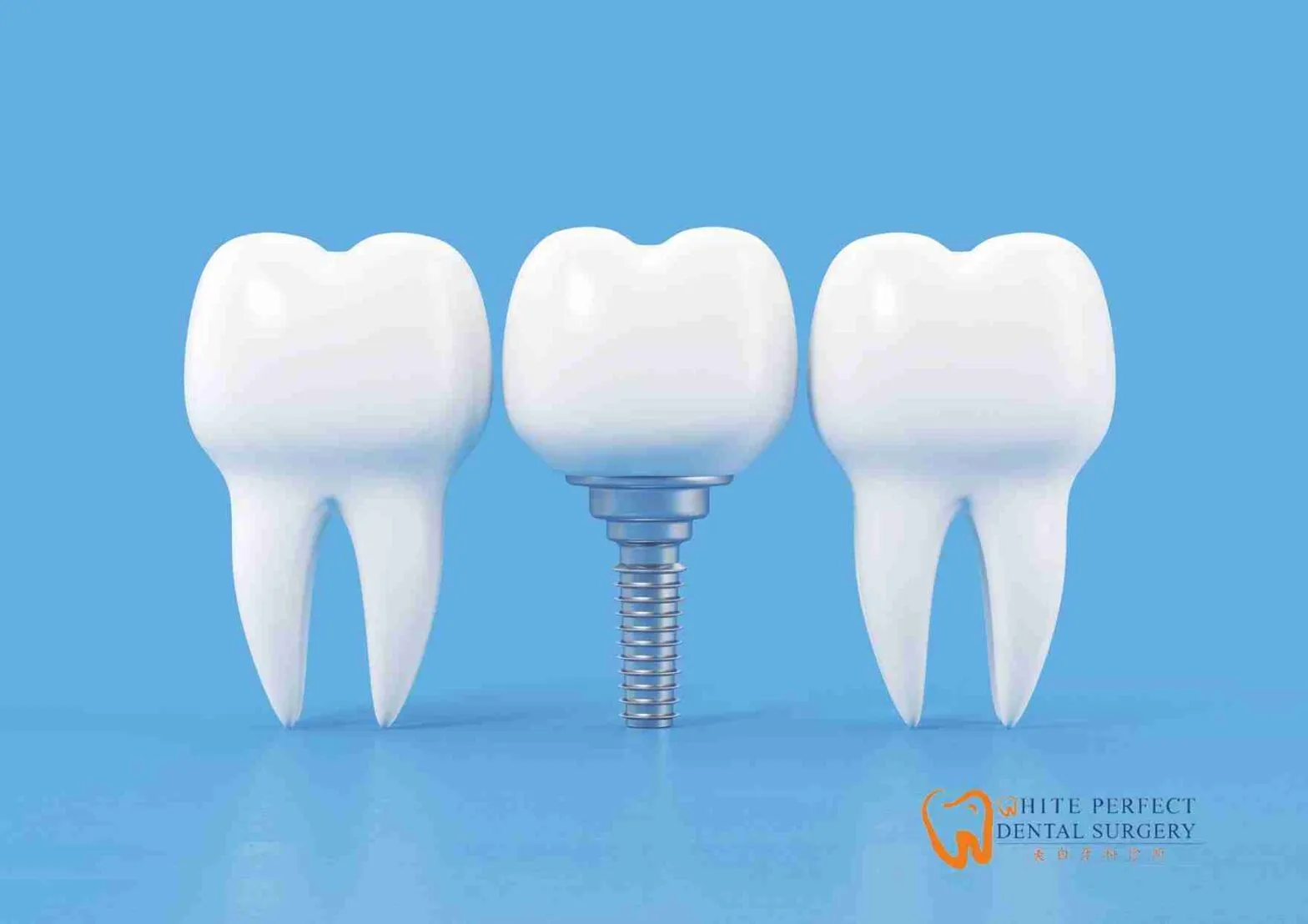 implant tooth cost in Malaysia